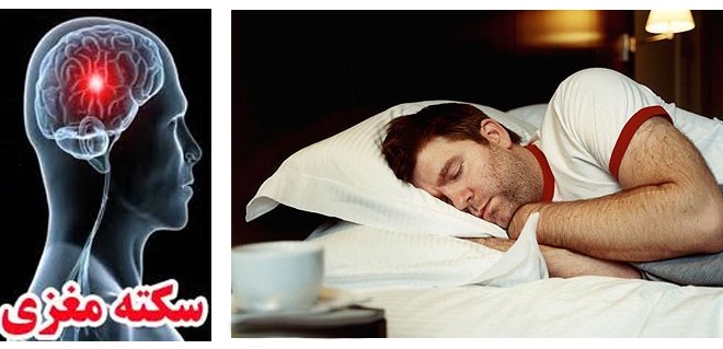 تاثیر میزان خواب بر سکته مغزی
