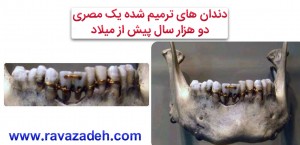 ترمیم دندان