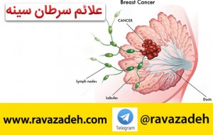 سرطان