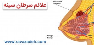سرطان
