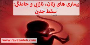 بیماری های زنان، نازایی و حاملگی: سقط جنين