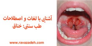 آشنایی با لغات و اصطلاحات طب سنتی: خناق