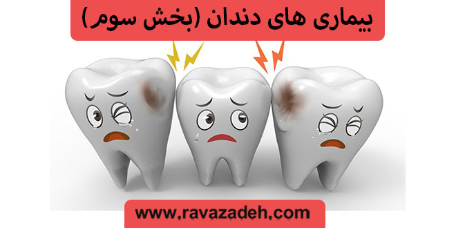 بیماری های دندان (بخش سوم)