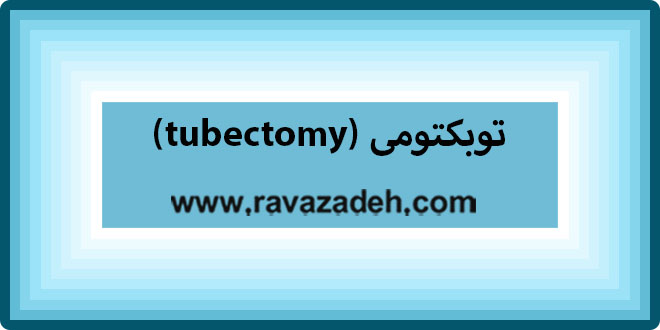 توبکتومی (tubectomy)