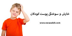 خارش و سوختگی پوست کودکان