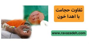 تفاوت حجامت با اهدا خون