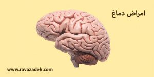 امراض دماغ