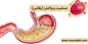 نکته های شنیدنی: حساسیت و واکنش (رفلکس)