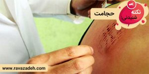 نکته های شنیدنی: حجامت