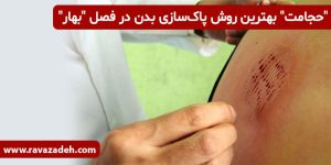 "حجامت" بهترین روش پاک‌سازی بدن در فصل "بهار"