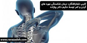 کلیپ شفایافتگان: درمان شکستگی مهره های گردن و کمر توسط حکیم دکتر روازاده